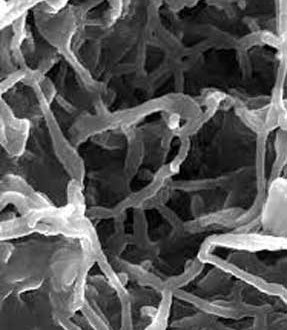 تولید قطعات زیستی برای پیوند های استخوانی در دانشگاه امیرکبیر